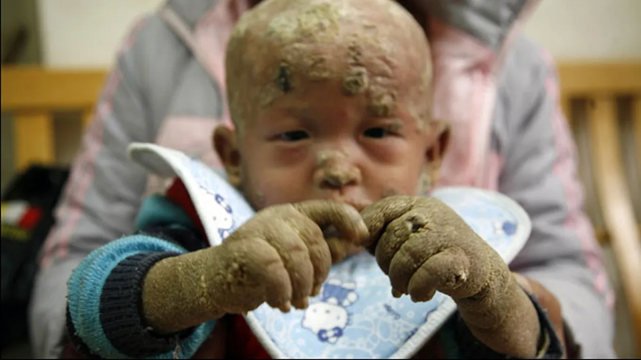 Copilul-peste i-a uimit pe doctori