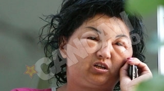 O femeie din Mehedinti a ajuns la Urgenta, mutilata de cosmetice! Vopseaua folosita era expirata!