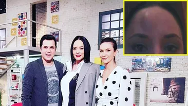 Andreea Marin, într-o ipostază neplăcută. Imaginile în care vedeta are un cucui în frunte, mare cât un ou: Am văzut la propriu stele verzi