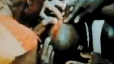 VIDEO socant! Vezi cum un vraci din Africa opereaza pe creier, pe viu!