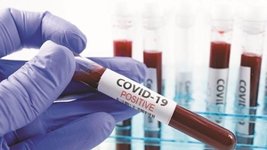 Coronavirus România, 27 februarie. 54 de decese s-au înregistrat în ultimele 24 de ore