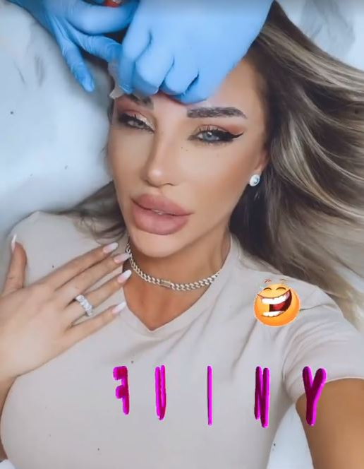 Bianca Drăgușanu, problemă delicată după o intervenție estetică: “Ce mi-o fi trebuit mie implant de sprâncene? O porcărie”
