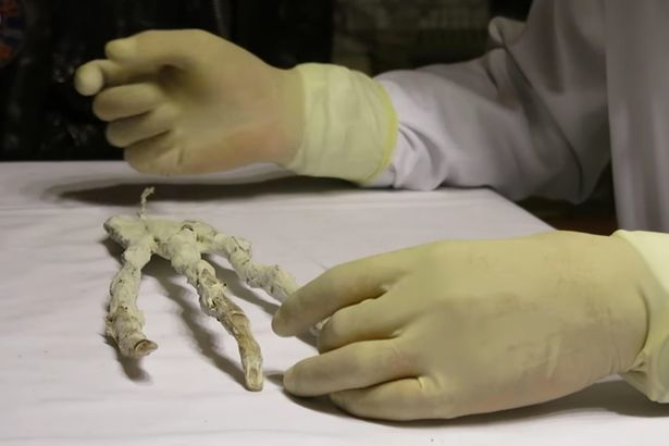 Au găsit mai multe cadavre ciudate şi au cerut părerea experţilor. S-au făcut câteva teste, iar rezultatele au fost şocante. Ce descoperiseră de fapt