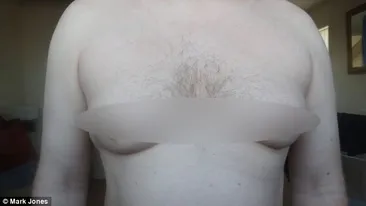 A vrut sa scape de sanii de femeie si sa arate ca un barbat normal! Rezultatul este insa INGROZITOR!