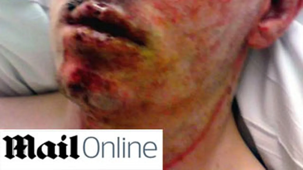 Un britanic a vrut sa fure niste cabluri de cupru si a fost prajit de 22.000 de volti