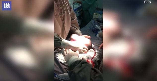 Imagini emoționante în sala de operații: un băiețel s-a născut în timp ce era încă în sacul amniotic. Cazul este foarte rar: 1 la 80.000 de nașteri | FOTO & VIDEO