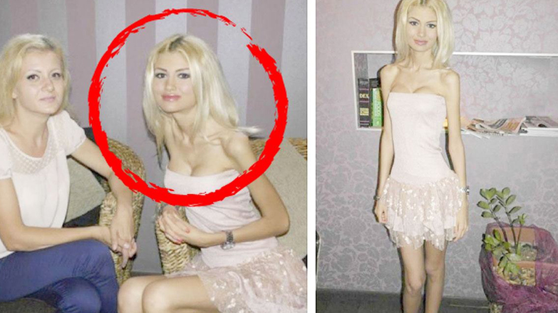 Flavia Apostol cântărea în 2013 doar 35 de kilograme. Cum arată acum, după ce s-a îngrășat