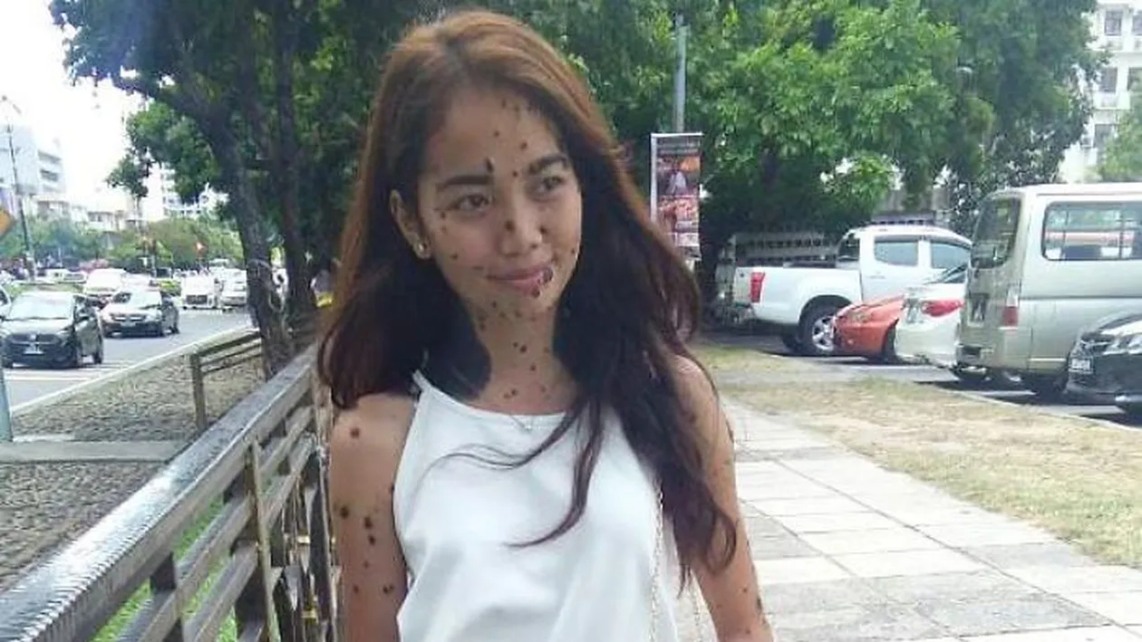 Această tânără a fost numită toată viaţa ei un „monstru“ din cauza felului în care arată, dar acum ar putea deveni următoarea Miss Univers!