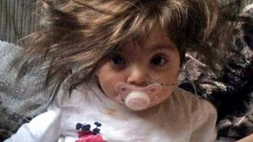 Fetiţa de opt luni care arată ca o păpuşă! Nimeni n-a mai văzut asemenea păr
