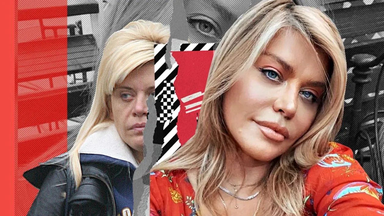 Imaginile pe care Loredana Groza le vrea șterse! Cum arăta artista înainte să fie acuzată că a trecut pe la estetician!