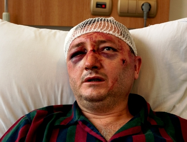Pe lângă problemele cu afacerile, Tofan a fost şi bătut în plină stradă