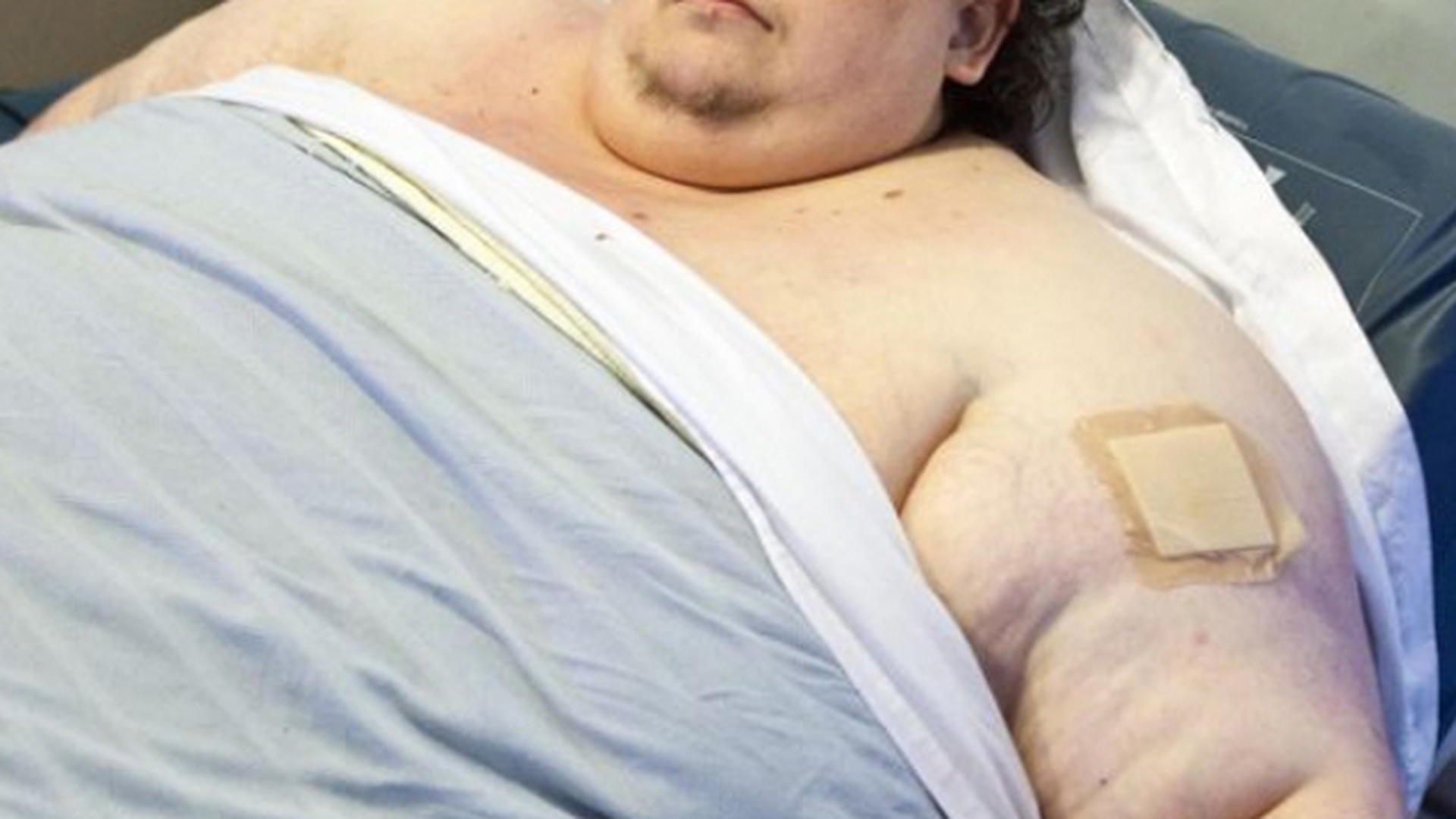 Avea 250 de kilograme si acum a ajuns la 90! Cum arata un roman dupa o asemenea transformare