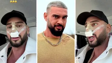 Dorian Popa, la un pas să îi „cadă nasul ca lui Michael Jackson”! Ce i-a descoperit medicul la operație? „Habar nu aveam”