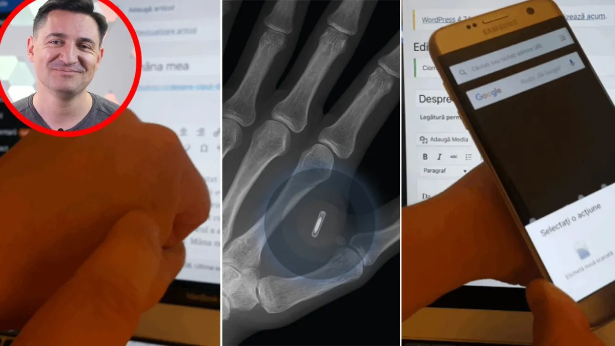 Motivul pentru care George Buhnici și-a implantat un microcip în mâna stângă: Un doctor mi l-a injectat cu o seringă