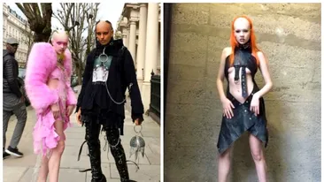 ‘Materie Fecala’, cuplul de pe Instagram care s-a viralizat imediat! Tinerii care arata ca extraterestrii sunt uluitori. De ce talpile ei arata ASA