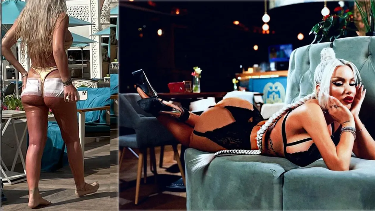 Loredana Chivu, primele reacții după ce s-a aflat că a avut grave probleme cu AQUAfilling-ul injectat în fese: “Visuri vechi” | FOTO