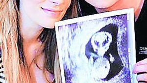 Ecografia i-a lasat fara cuvinte pe doi britanici: "Vom avea un bebe extraterestru?"