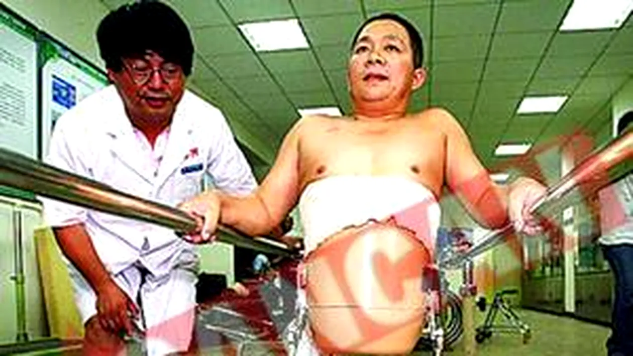 Barbatul cu picioare bionice