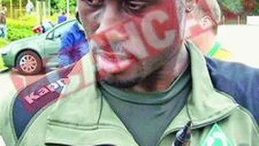 Toure si Sanogo sunt bolnavi de malarie