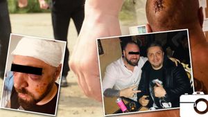 Ce a apărut pe pagina temutului interlop, la un an de când a fost snopit în bătaie: ”Am văzut moartea cu ochii...”