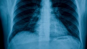 Reactia scandaloasa a medicilor romani dupa ce au ramas socati in fata acestei radiografii. Ce au vazut in ea