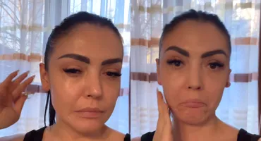 Ce truc folosește Andreea Mantea ca să își dezumfle fața. Așa ceva... „Doare un pic!”