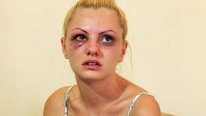 Alexandra Stan, dezvăluiri despre bătaia pe care a primit-o de la Marcel Prodan. " Ca să ajungi agresor, ai și tu niște probleme emoționale… " + Cum a reușit să depășească perioada neagră din viața ei 