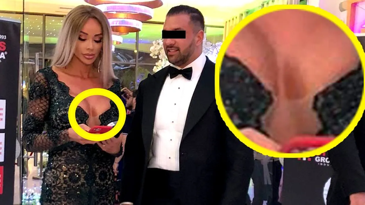 Bianca Drăgușanu, cu o vânătaie imensă pe bust. A fost lovită în sâni?!