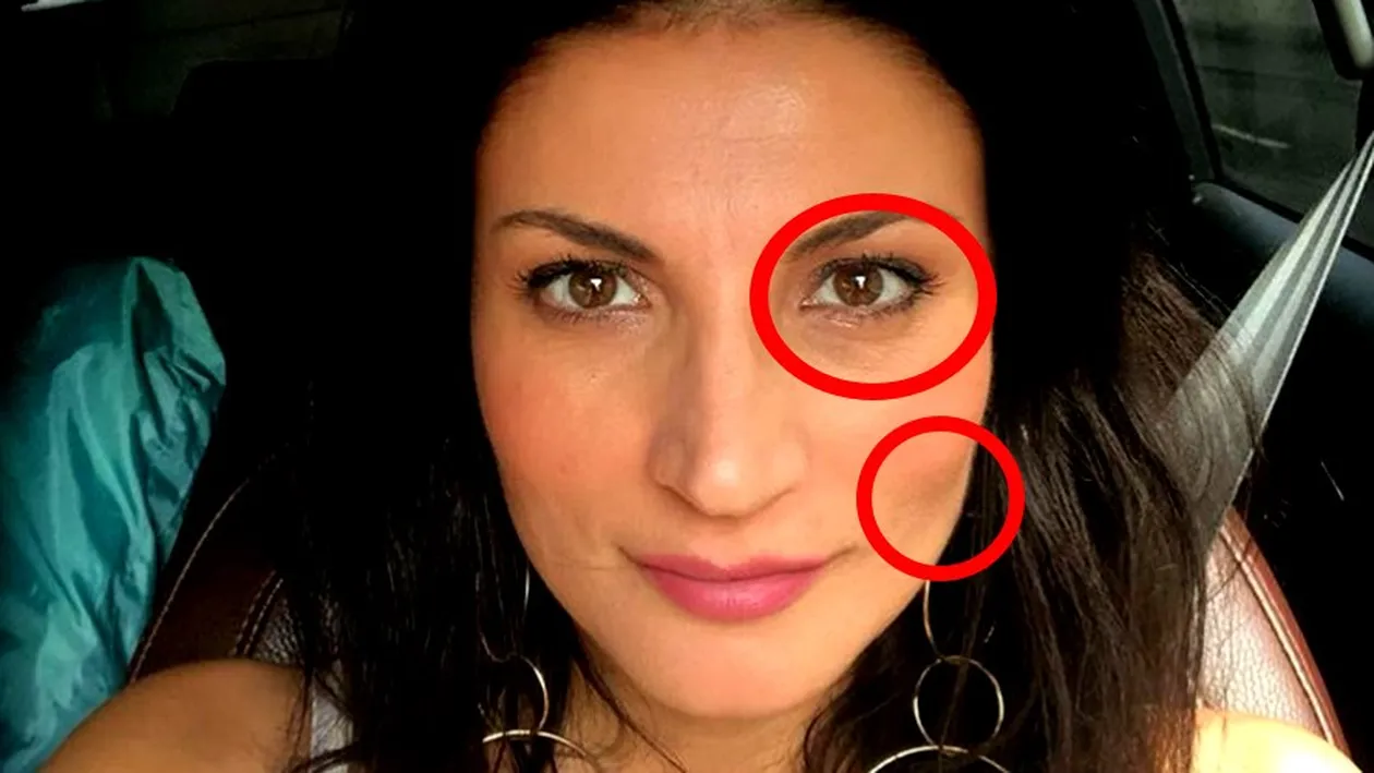 Ioana Ginghină a apărut cu un ochi umflat în public! Oare cine a lovit-o?