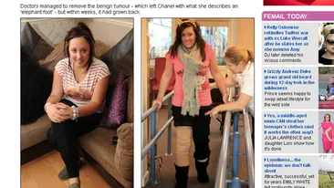 O balerina de 15 ani a acceptat sa ii fie taiat piciorul, ca sa mai poata dansa! VEZI AICI de ce