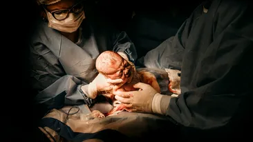 Incredibil! O femeie de 40 de ani cu sarcină extrauterină a născut un copil sănătos, deși sarcina s-a dezvoltat în abdomen