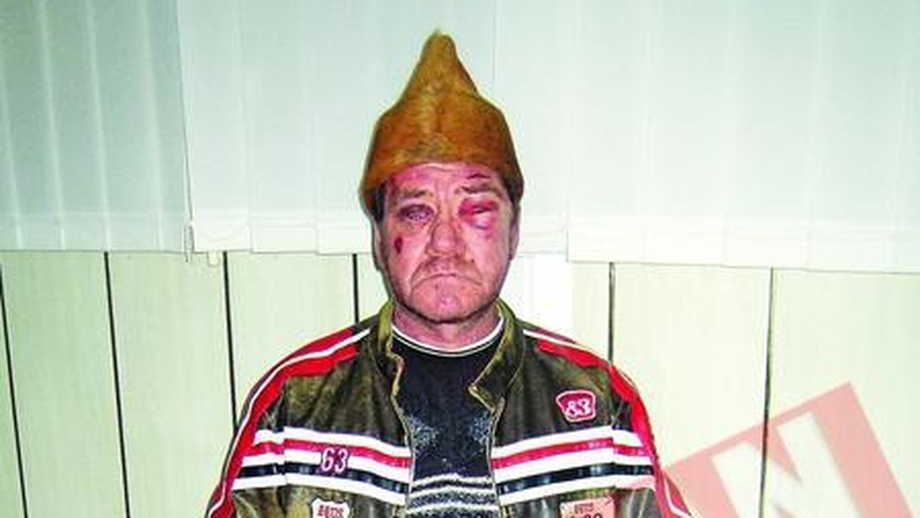 Si-a desfigurat sotul pentru ca nu mai era bun la pat