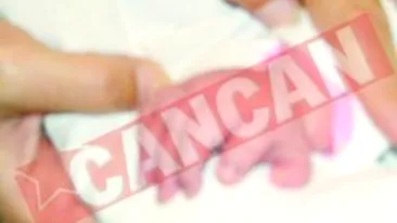 S-a nascut cu sase degete la o mana