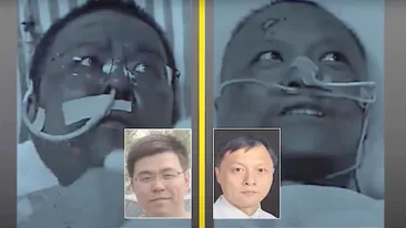 Incredibil! Infectați cu noul coronavirus, doi medici chinezi s-au trezit cu pielea închisă la culoare! Explicațiile specialiștilor