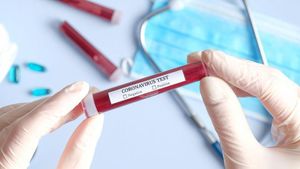 Cât costă un test pentru coronavirus. Un medic a dezvăluit suma