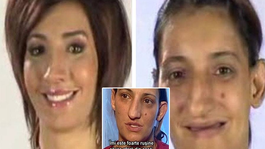 “Vrăjitoarea” de la “Frumusețe pe muchie de cuțit” a rămas din nou fără dinți? Cum a fost fotografiată Nadia Danciulescu în costum de baie, în urmă cu doar câteva zile