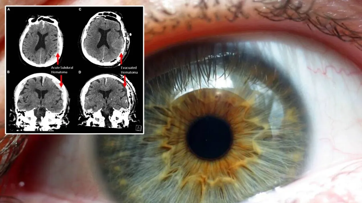 Descoperire ireală a oamenilor de știință. Ce se întâmplă după ce mori, de fapt. Mitul a devenit realitate
