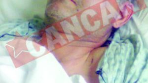 Si-a strivit craniul cand a cazut de pe schela