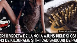 HORROR! O vedeta de la noi a ajuns piele si os! "Am doar 43 de kilograme si imi cad smocuri de par!"