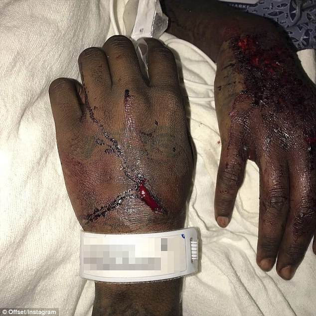 GALERIE FOTO. Cum arată Offset, logodnicul lui Cardi B, după ce și-a făcut praf bolidul de 80.000 de dolari. „Puteam fi mort!”