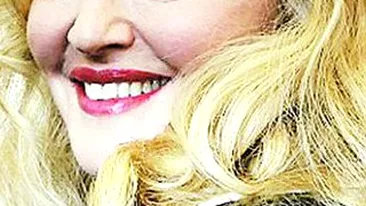 Madonna arata ca Femeia-Pisica! Ambele au gura si pometii deformati