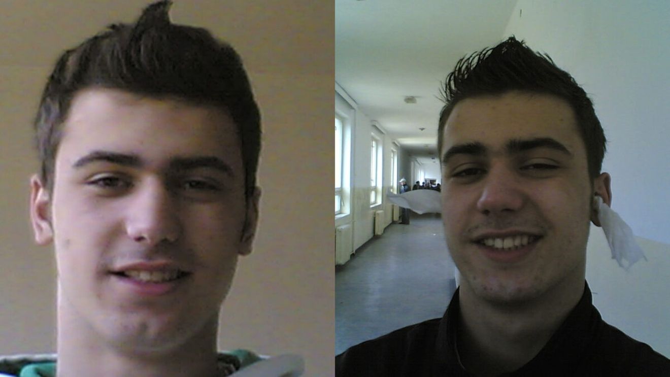 Îl recunoști? Sportivul celebru din România tocmai și-a făcut implant de păr