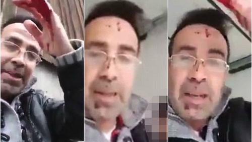 Imagini înfiorătoare! Plin de sânge, un bărbat a făcut live pe Facebook, după ce și-a înjunghiat mortal soția: „Așa sfârșești dacă îți enervezi soțul”