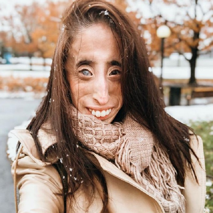 A fost catalogată “cea mai urâtă femeie din lume”, iar acum… Cum arată, în prezent, Lizzie Velasquez