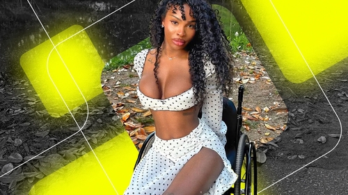 „Barbie în scaun cu rotile”, povestea influenceriței care inspiră milioane de oameni. Afecțiunea rară care i-a schimbat radical viața