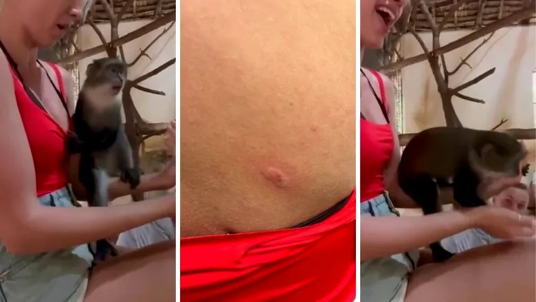 Vedeta din România care a fost mușcată de maimuțe în vacanță: „Nu am fost la doctor. Mi-a zis ChatGPT să stau liniștită”