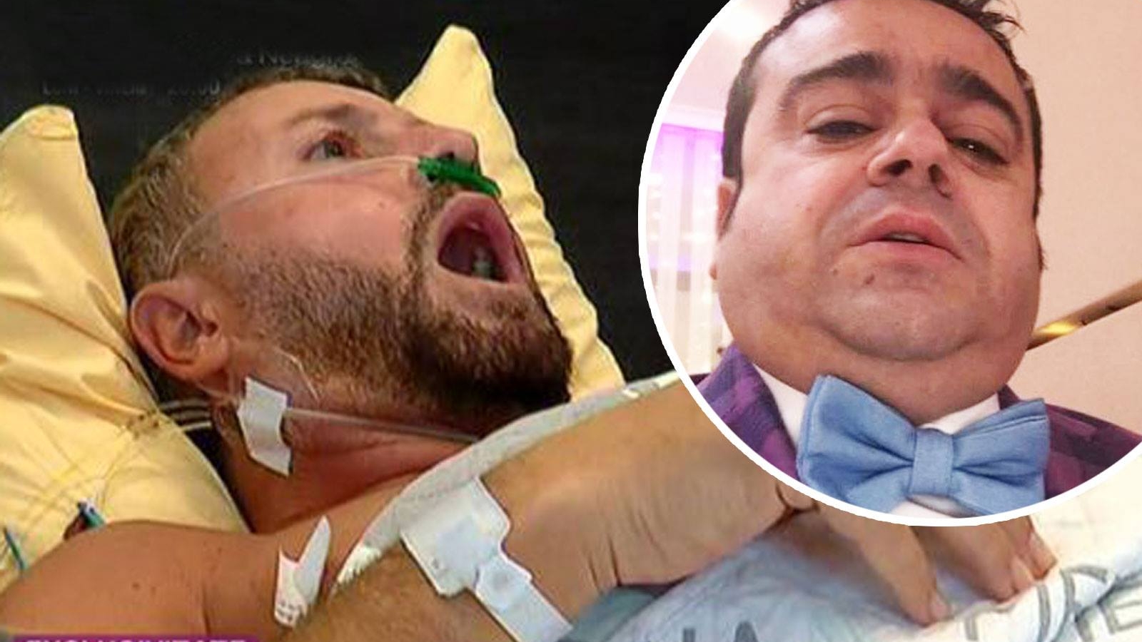 Cum l-a fotografiat Adrian Minune pe Cătălin Botezatu, după ce a fost operat de tumoră rară