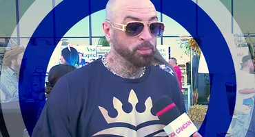 Cum arată CRBL după blefaroplastie. Ochii lui s-au învinețit