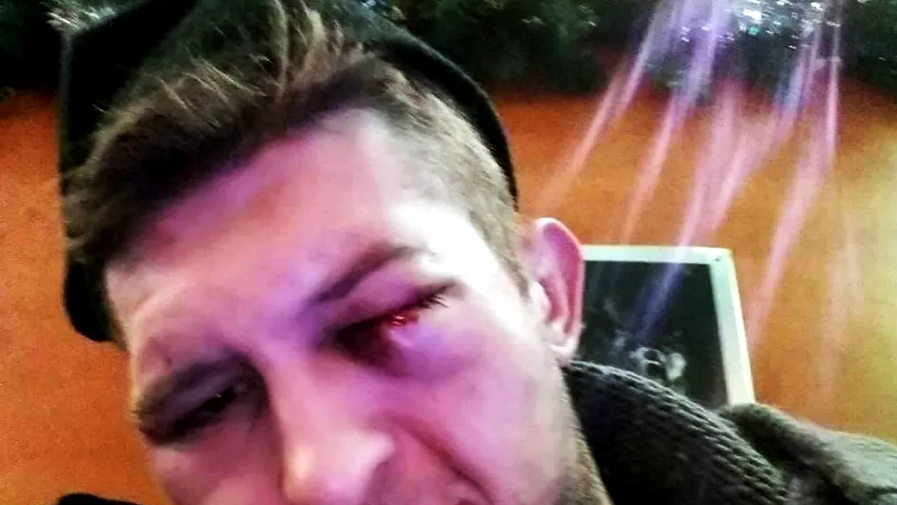 Fost fotbalist bătut cu sălbăticie într-un magazin! Imagini dure pe camerele de supraveghere