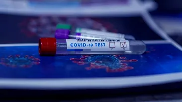 Teste diagnostic și anticorpi COVID-19. Cum afli dacă ești infectat sau dacă ai avut infecția în trecut 